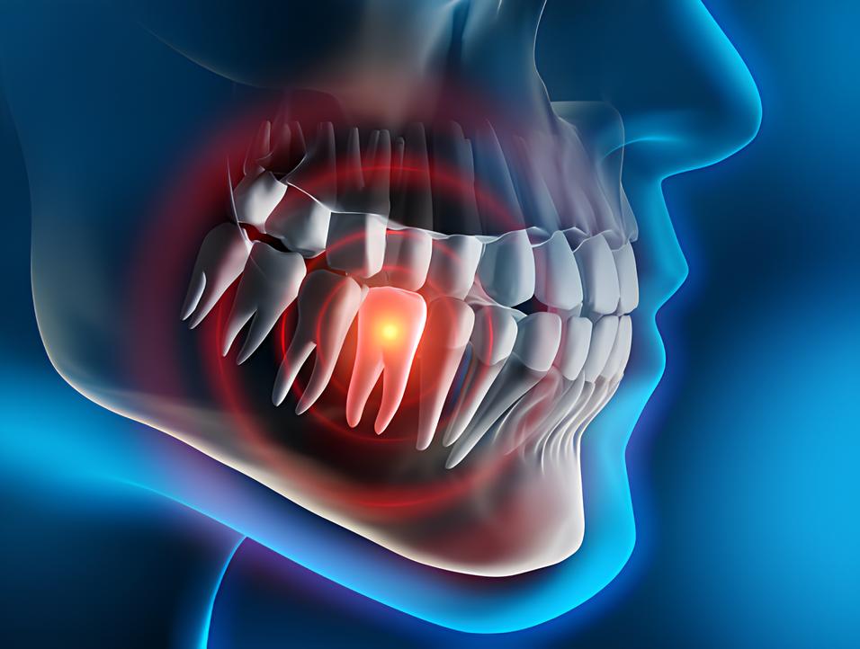 Teeth image - Emergency dentist Berkhamsted